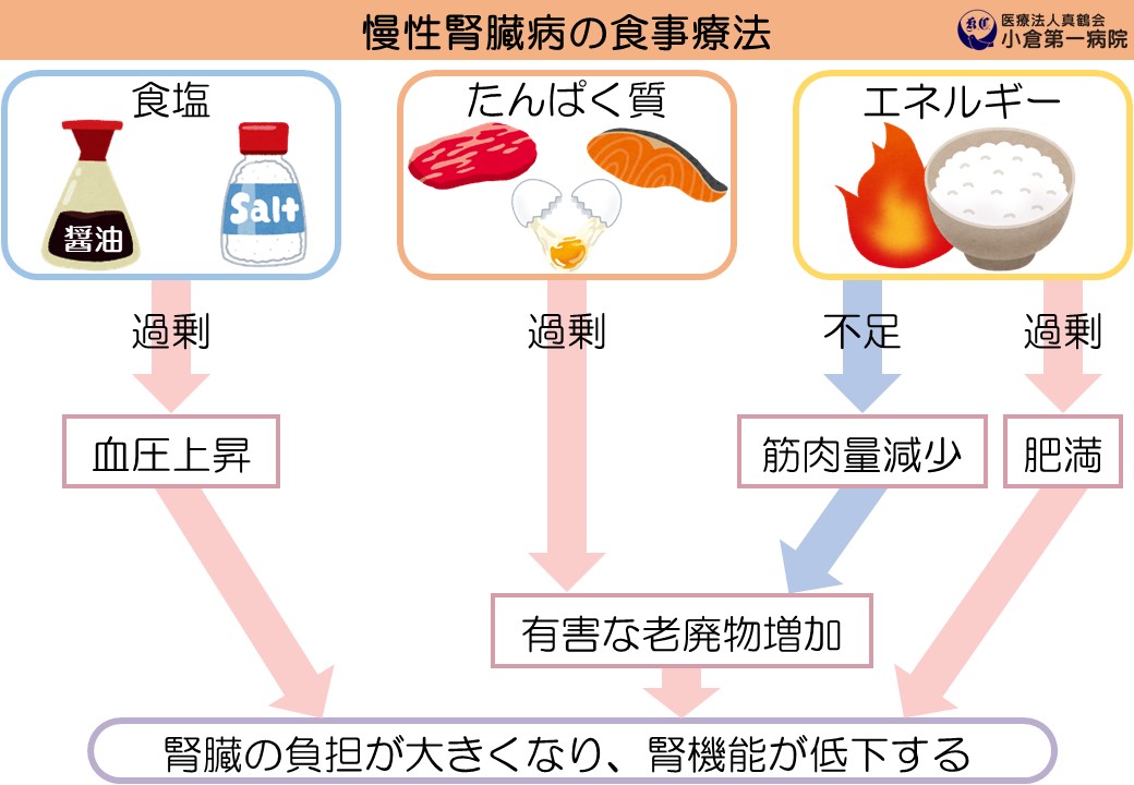 慢性腎臓病は低栄養になりやすい！？食事を楽しむコツ」（児玉 佳菜 